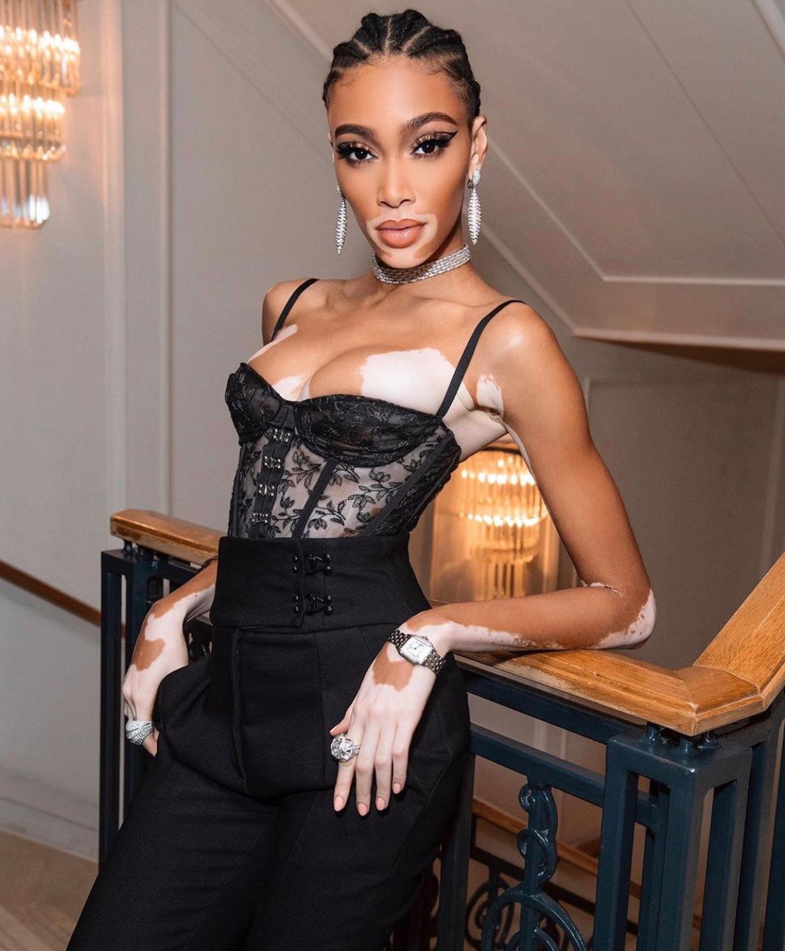 Winnie Harlow | GQ Men of the Year After Party