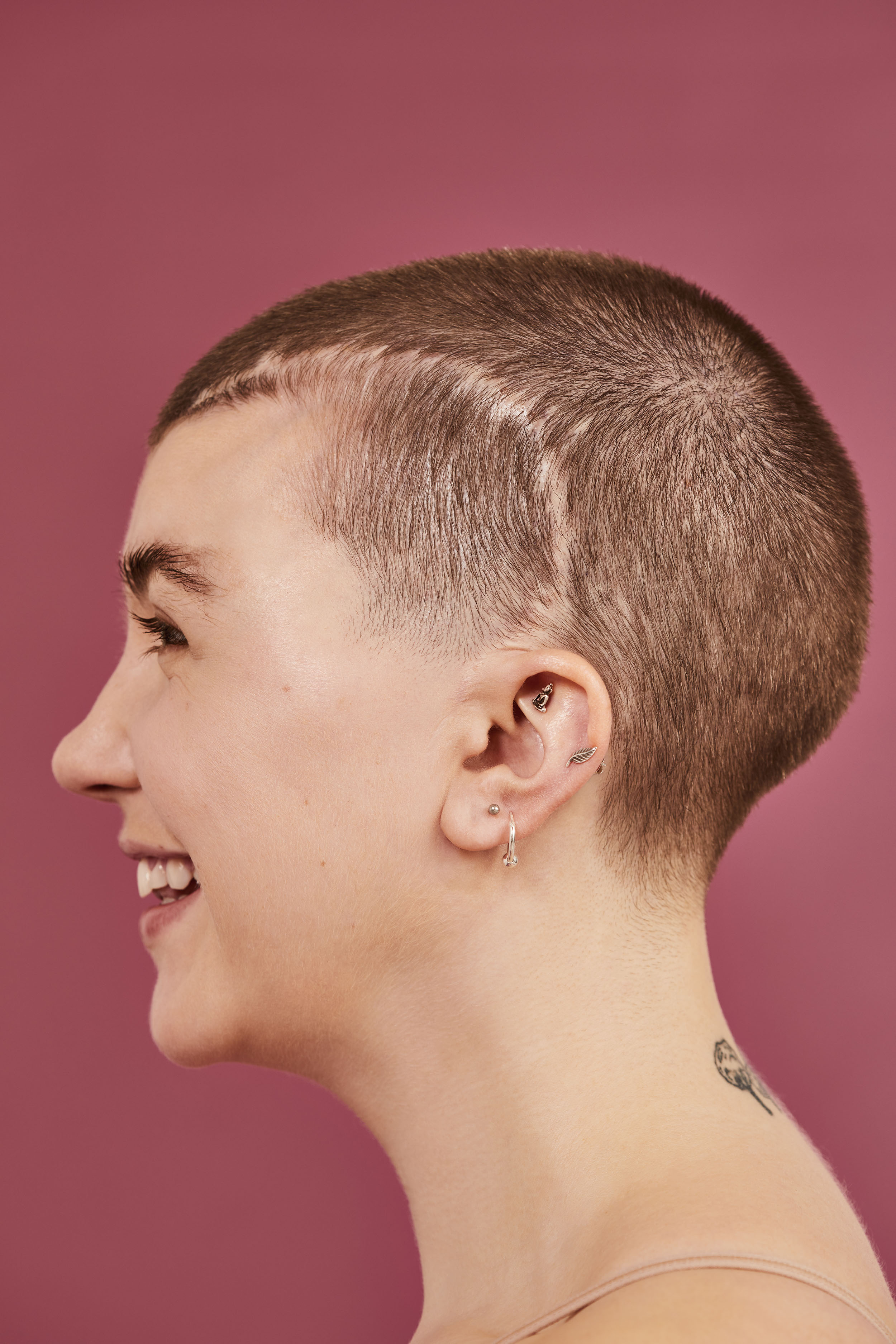 Grazia | My Scars Tell My Story