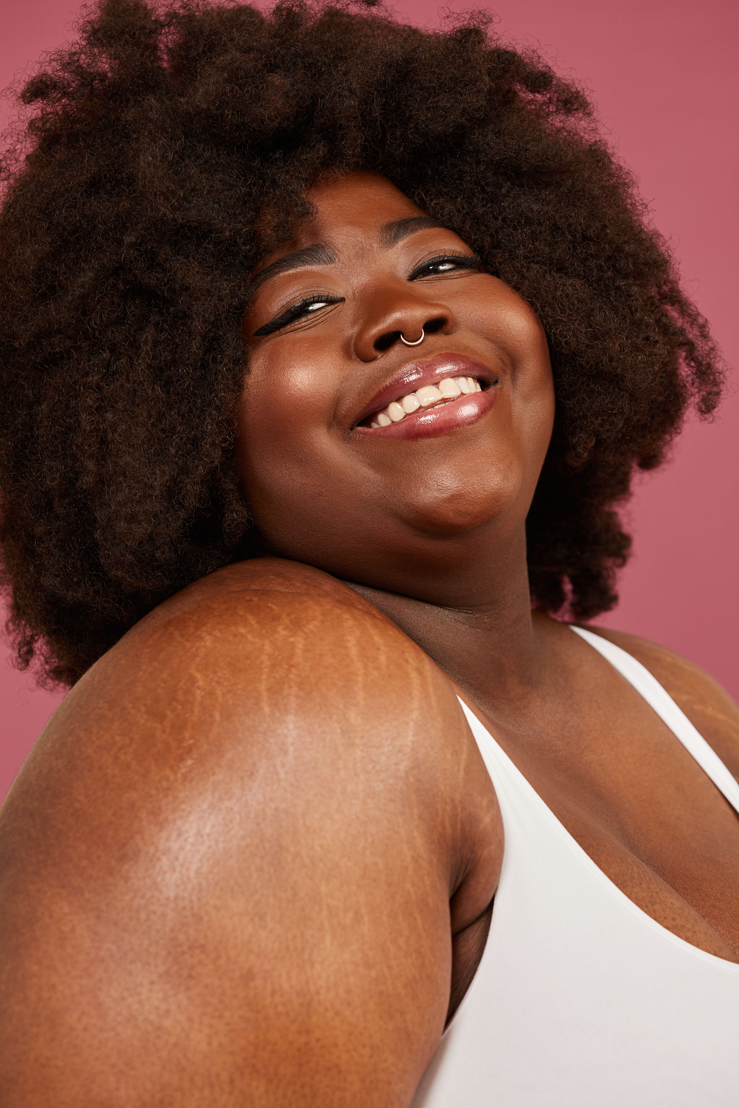 Grazia | My Scars Tell My Story